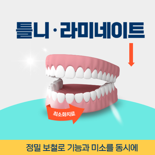 제천치과 제천시 치과 틀니 라미네이트