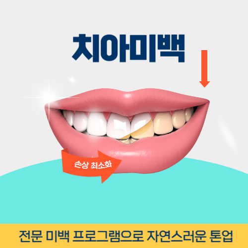 제천치과 제천시 치과 치아미백