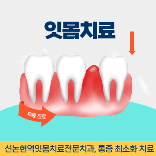제천치과 제천시 치과 잇몸치료